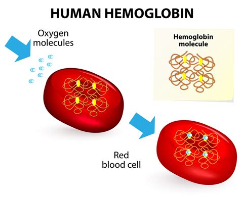 Hemoglobinopathy .
